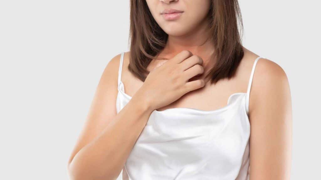 Dermatite atópica em adultos: sintomas, gatilhos e como cuidar da pele sensível