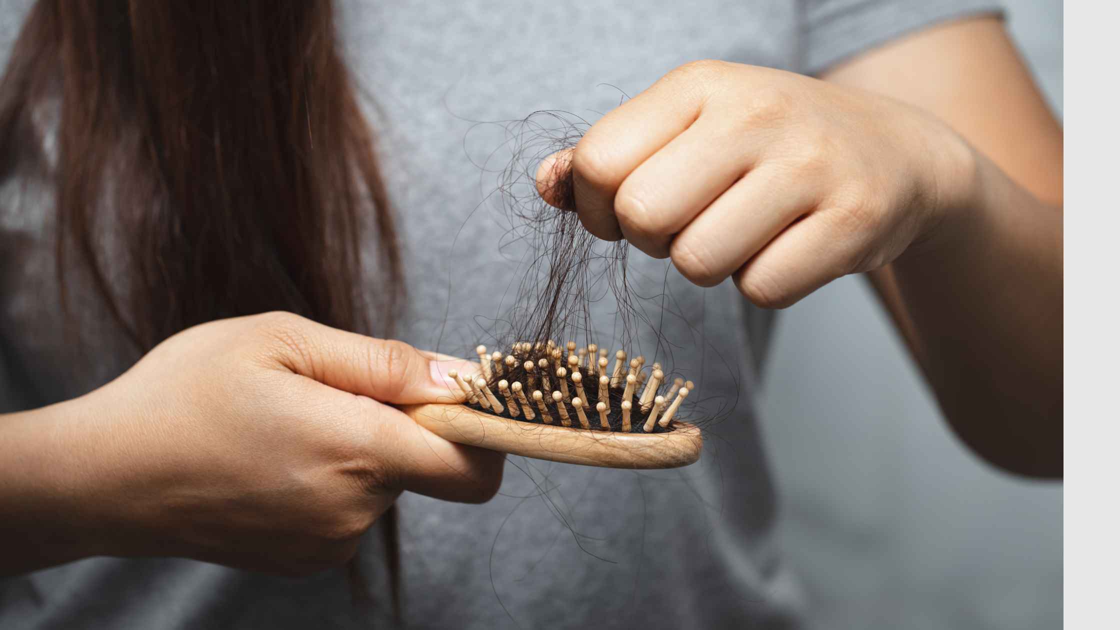 Queda de cabelo: causas mais comuns e os tratamentos dermatológicos mais eficazes.