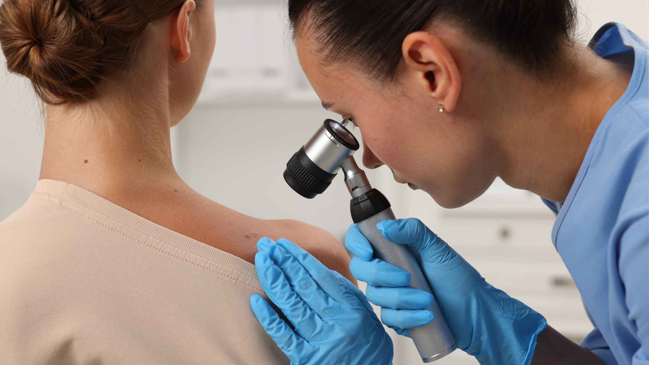 Câncer de pele: como identificar sinais suspeitos e quando procurar o dermatologista.