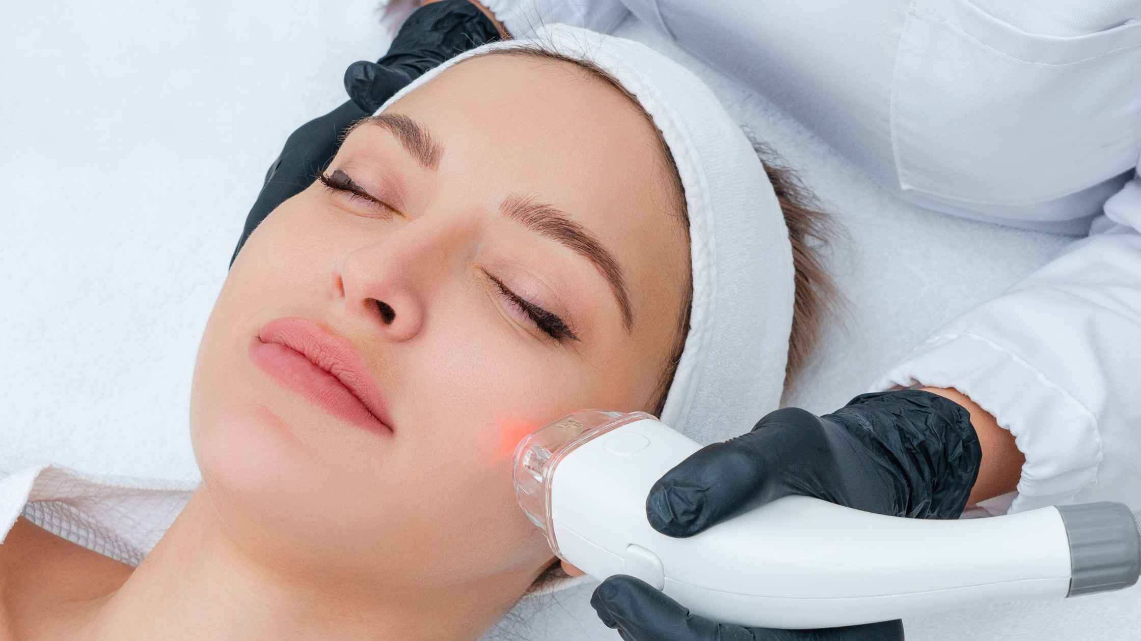 A Revolução do Laser na Dermatologia: Precisão, Segurança e Resultados